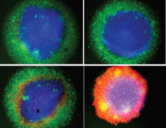 Fluroeszenzmikroskopie von Brustkrebs-Organoiden © Momburg/DKFZ