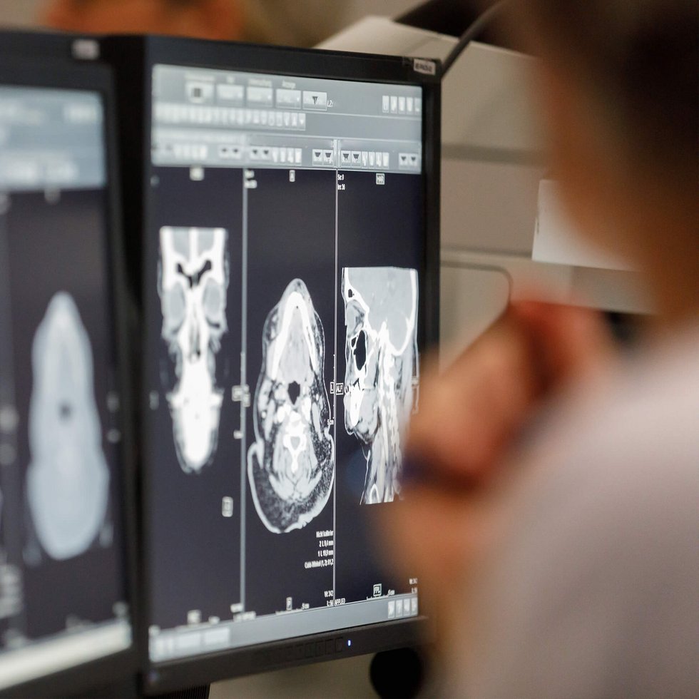 Precision Local Therapy and Image Guidance