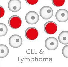 CP CLL & Lymphoma