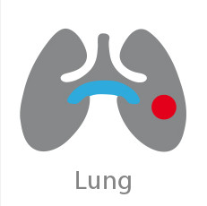 CP Lung