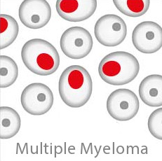CP Multiple Myeloma